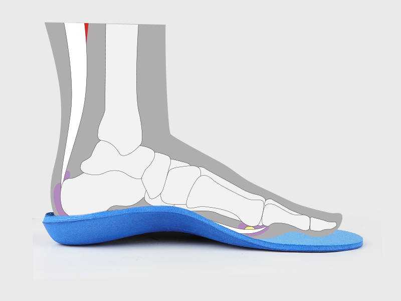 The Best Arch Support Insoles For Plantar Fasciitis and Flat Feet WALKHERO